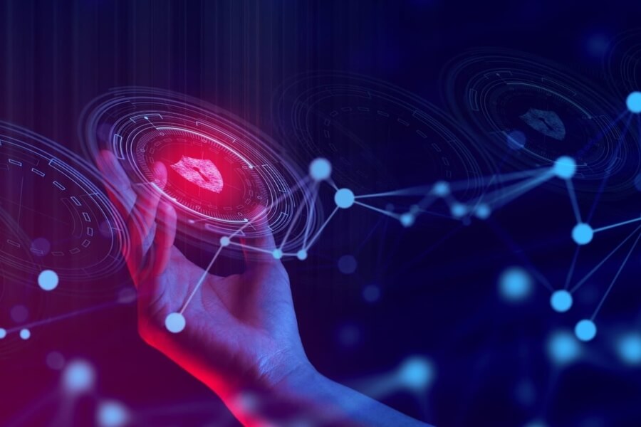 Rủi ro bảo mật khi quản lý công nợ bằng Excel